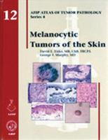 Melanocytic Tumors of the Skin