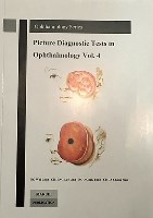 Picture Diagnostic Tests in Ophthalmology - Volume 4